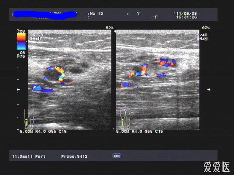 超声医学讨论版 - 爱爱医医学论坛