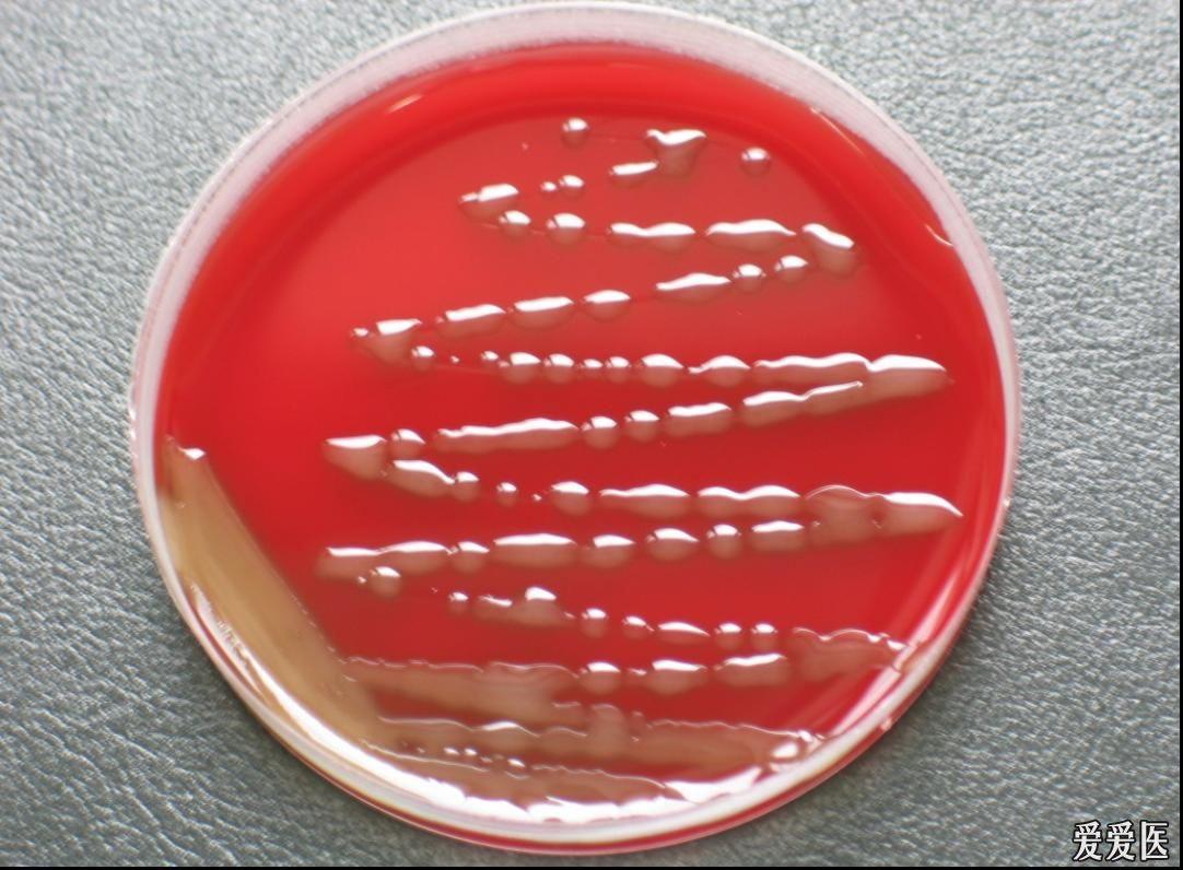 链球菌菌落图片