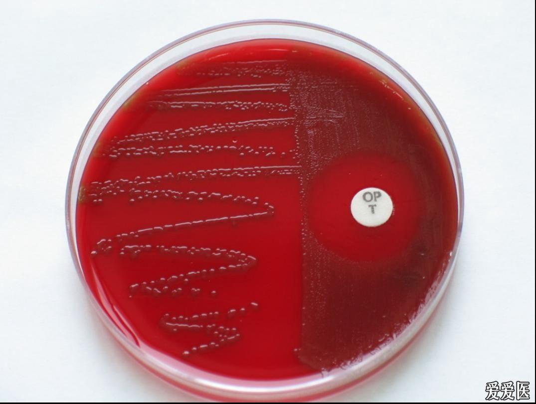 考考你的眼力8看图识菌肺炎链球菌