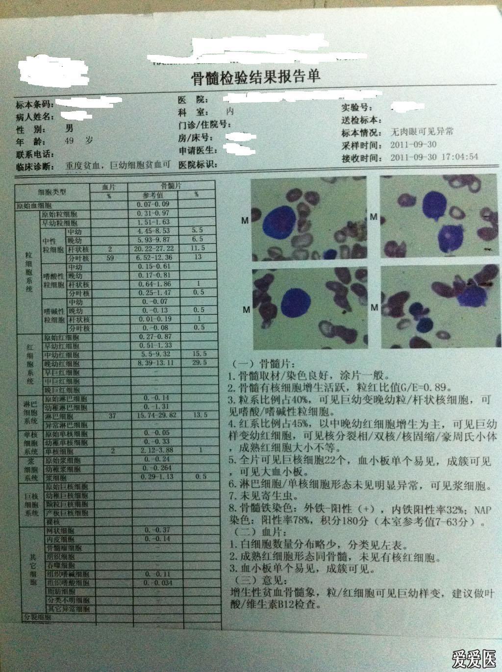 骨髓涂片手法图片