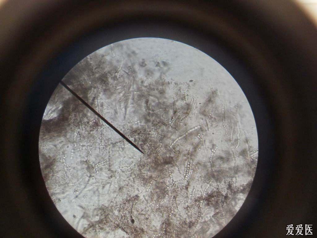 有奖猜答公布答案须癣真菌6人回答准确均加1分