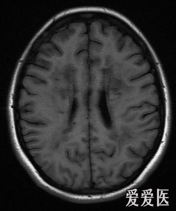 世界罕见疾病有多少种 120105220131e19df4ac6e1e53.jpg