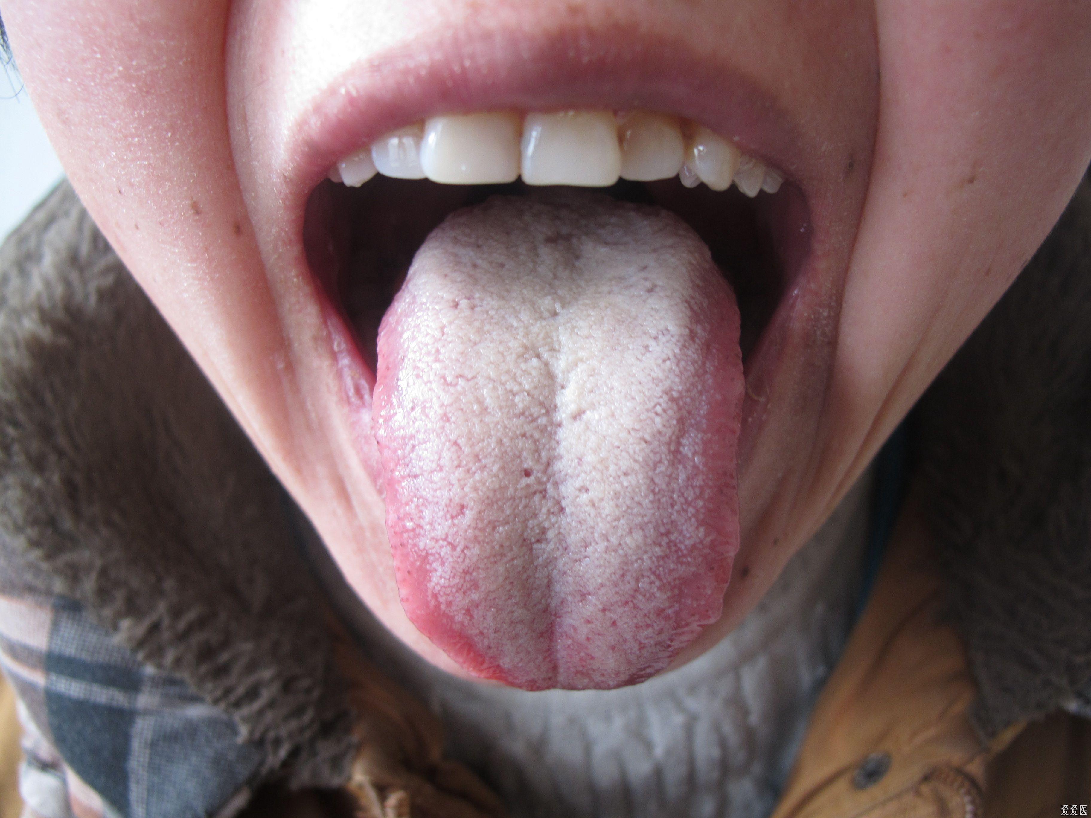 正常舌头照片图片