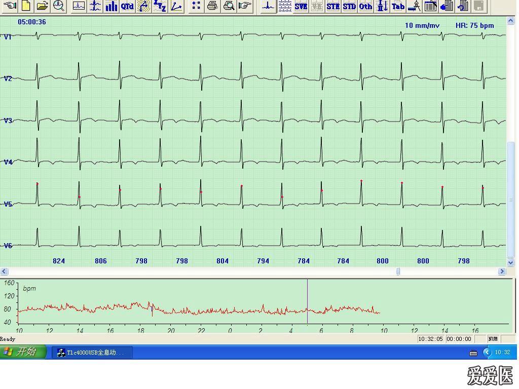 动态心电图报告结论 1202221048647bd0e649176042.jpg