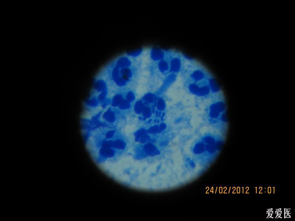 淋病双球菌图片图片