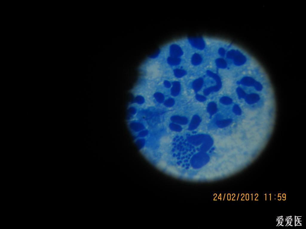 淋病双球菌图片