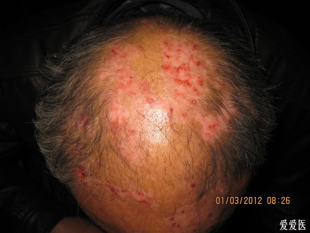 看图识病----------------