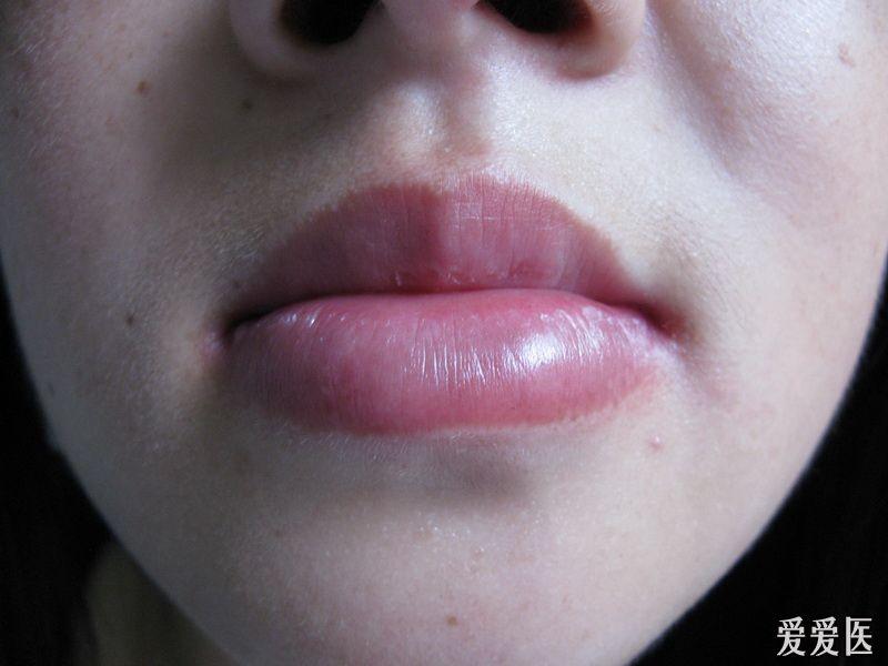 女孩红红的下唇