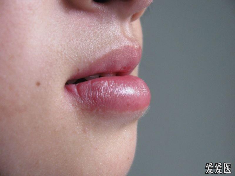 女孩红红的下唇