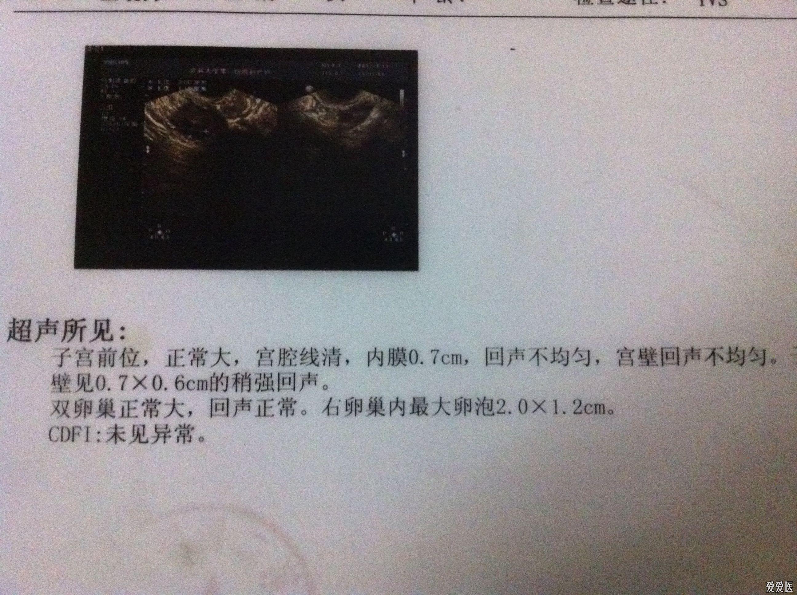 阴超子宫后位前壁图图片