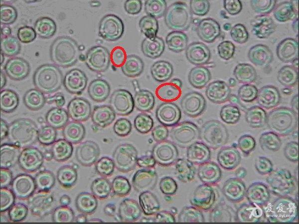 尿液棘形红细胞图片图片
