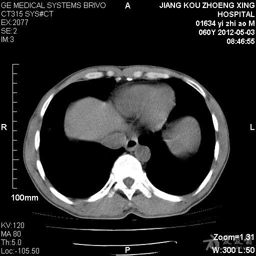 胰腺炎? - 医学影像学讨论版 - 爱爱医医学论坛