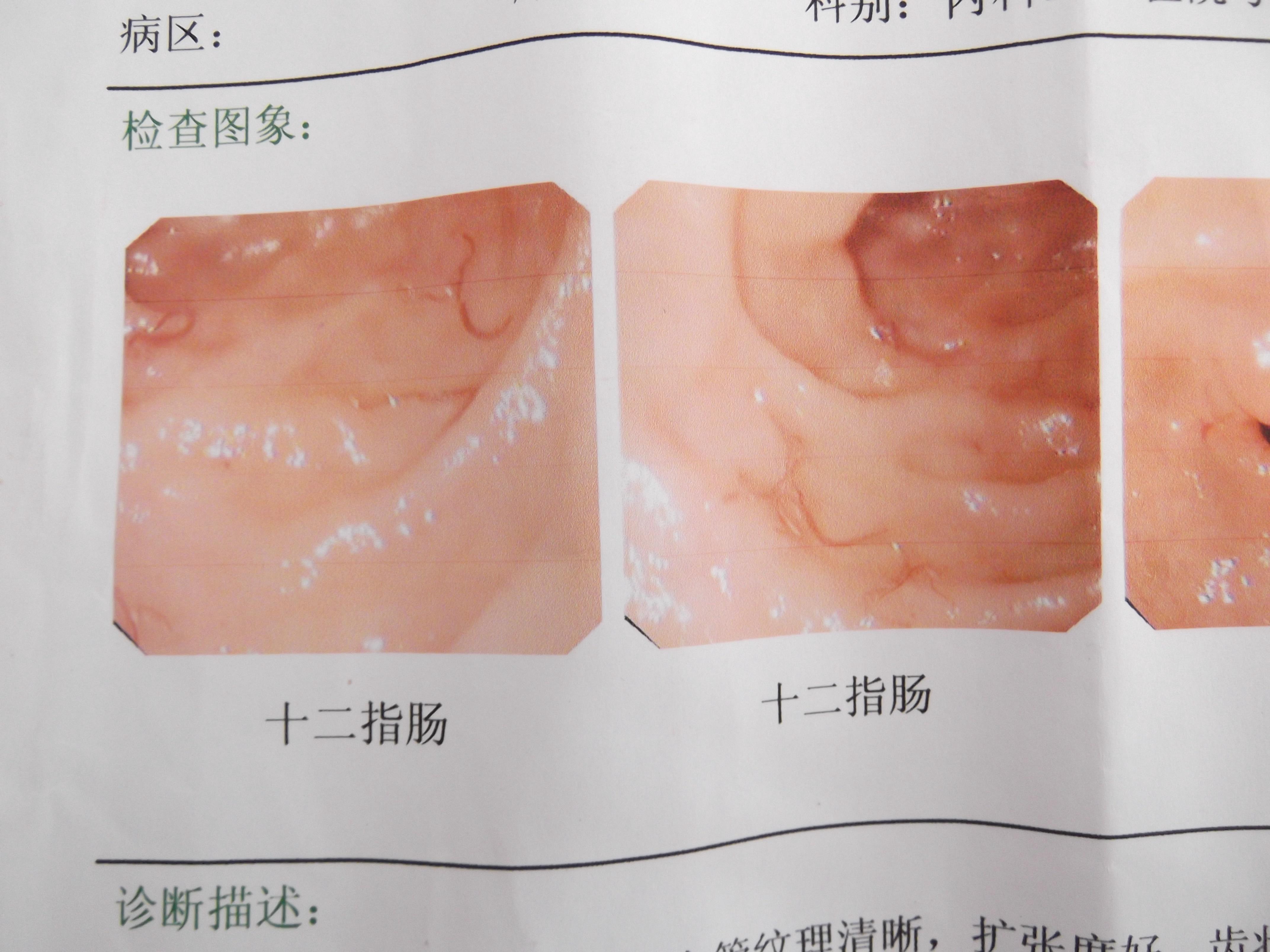 十二指肠  鲜花