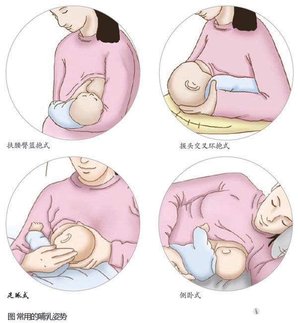 产后哺乳不适的处理