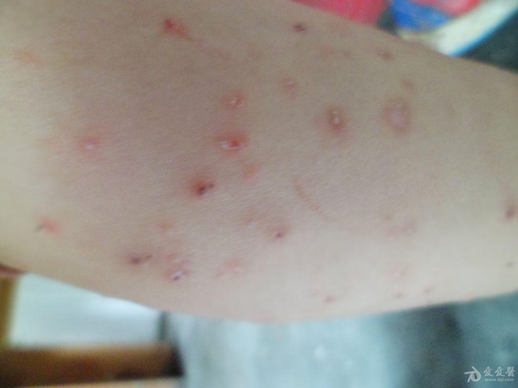 这个小孩皮肤病,恐怖