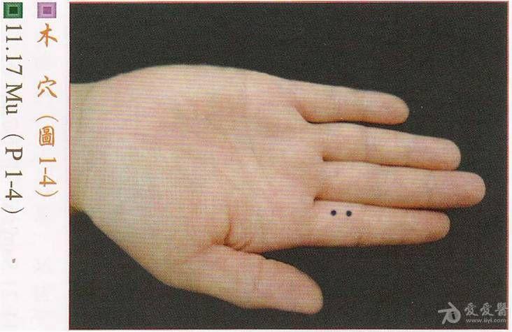 木穴治疗手上山药过敏,立竿见影