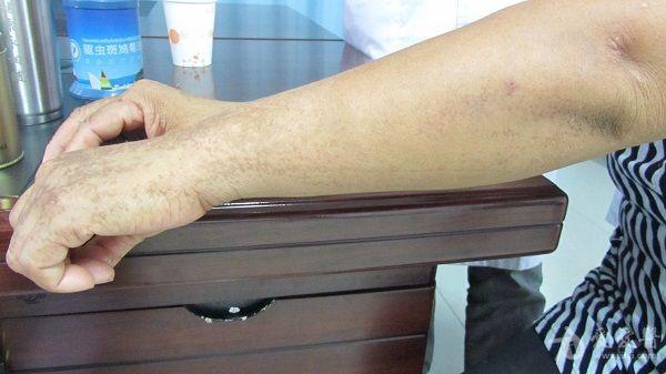 看图识病———色素异常症