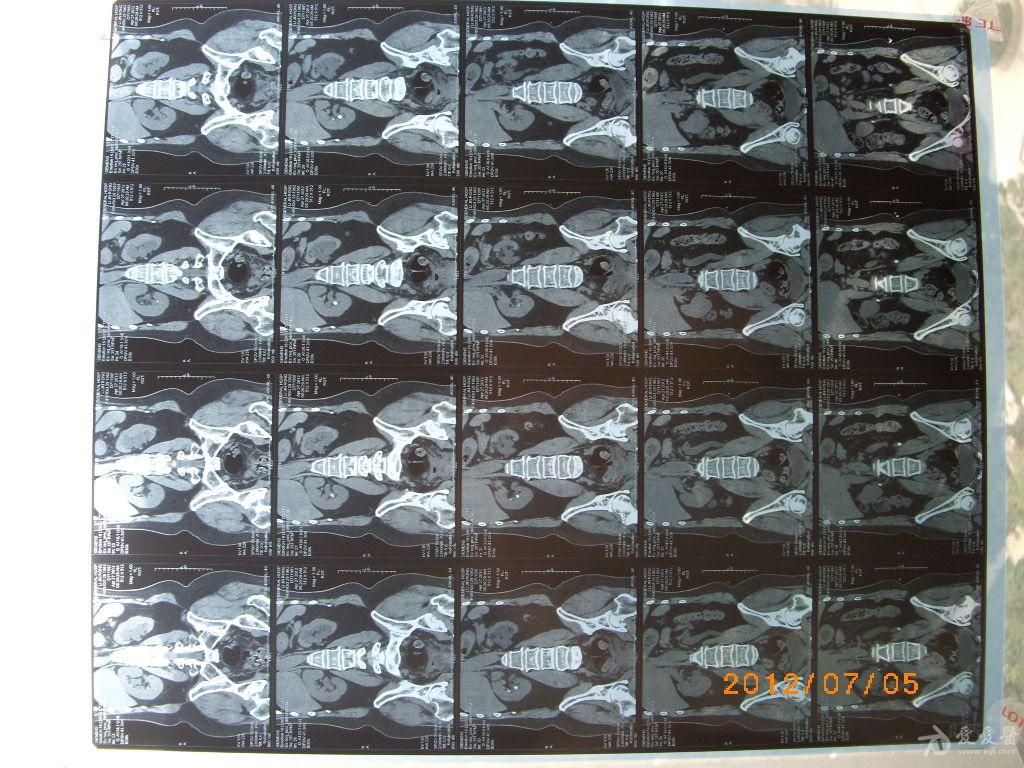 右侧髋关节可能骨岛轻微强迫整个身体右侧酸胀痛各位帮忙分析分析