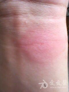 求助我的ppd实验72小时