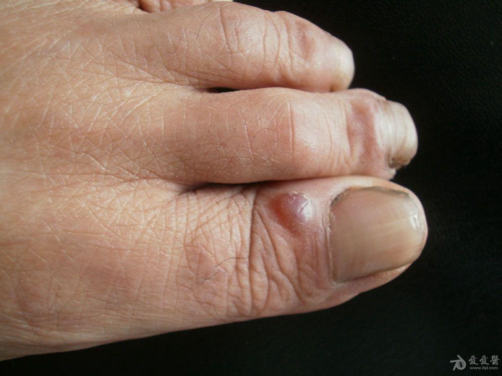 猜图病例39答案粘液样囊肿前5名回答准确者加分