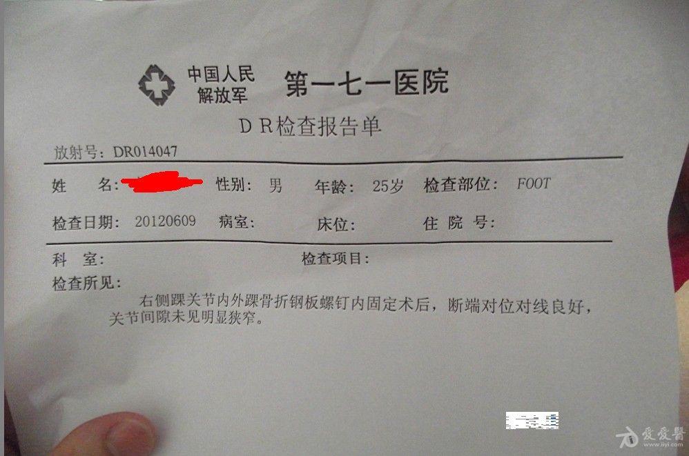 脚踝骨折伯伯婶婶大叔大婶大哥兄弟们 给看看吧在此感谢你们