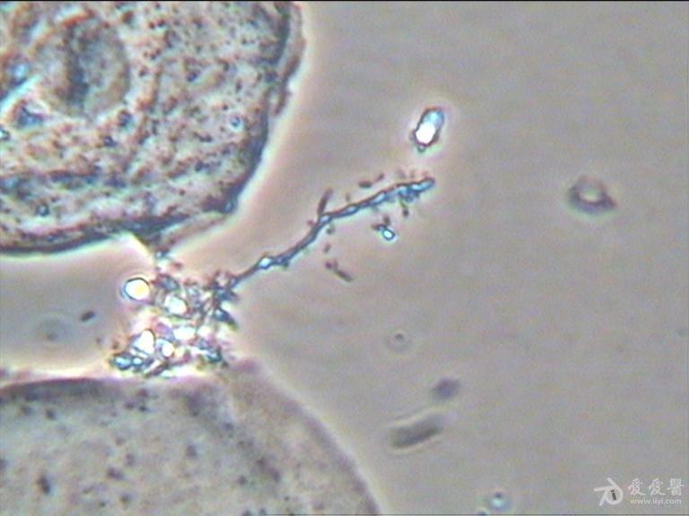白带霉菌显微镜图片