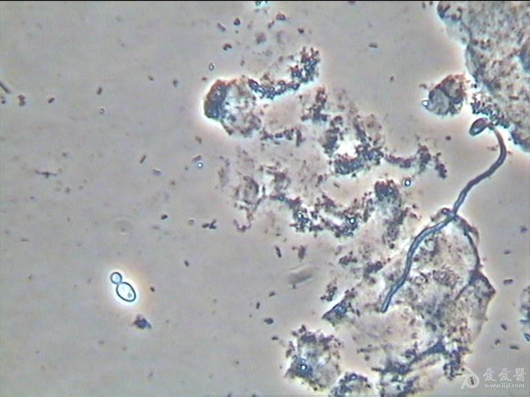 白带真菌孢子图片