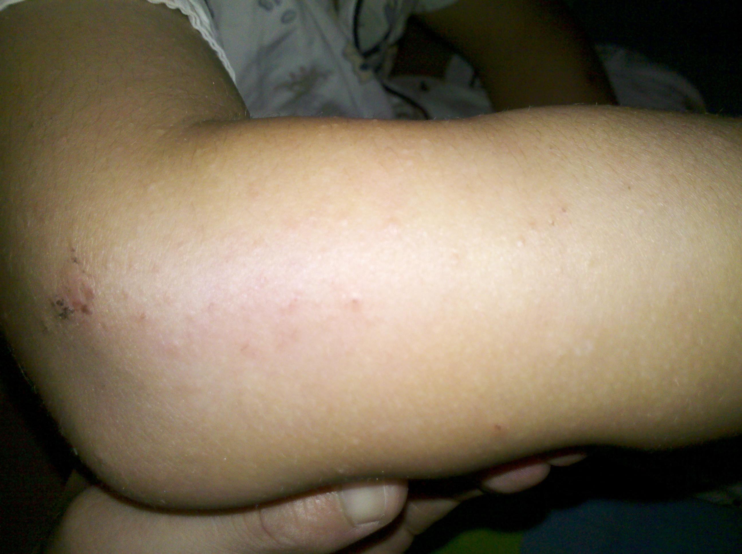 看看我们家宝宝的胳膊