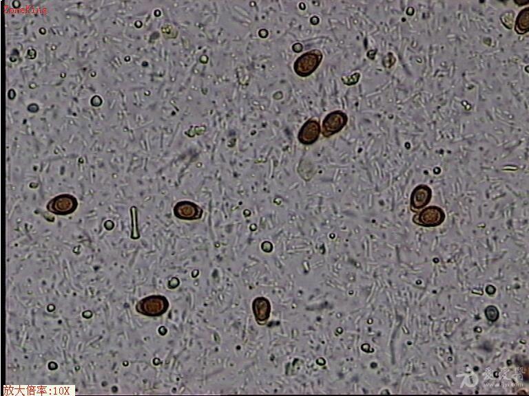 大便真菌孢子图片图片