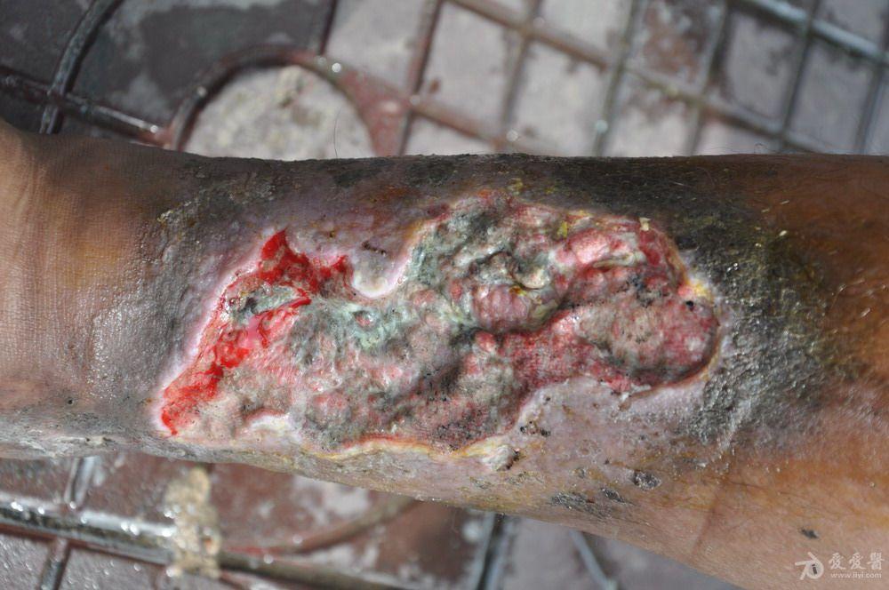 当今社会居然还会出现这样的伤口