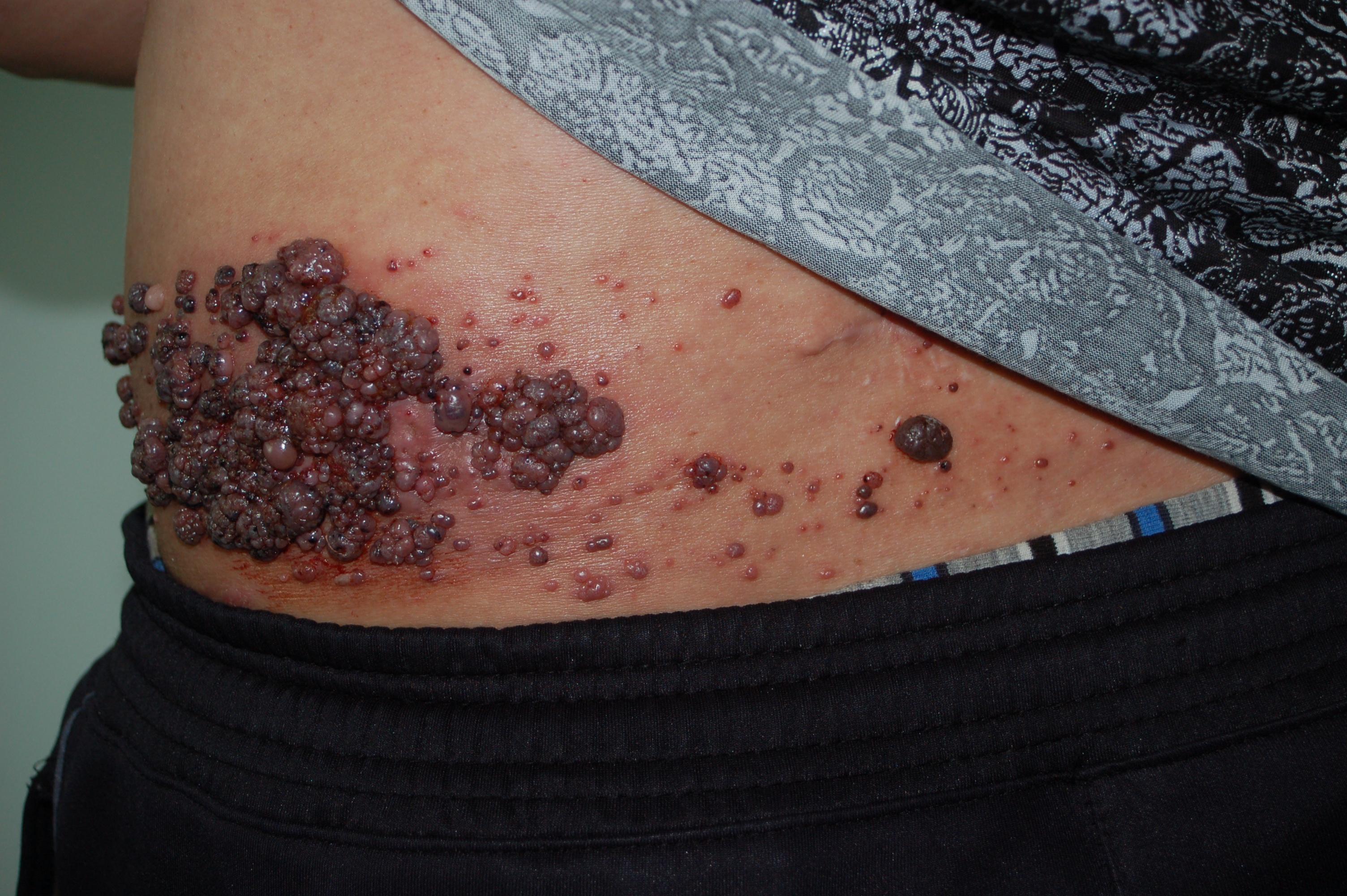 看图诊病--请诊断