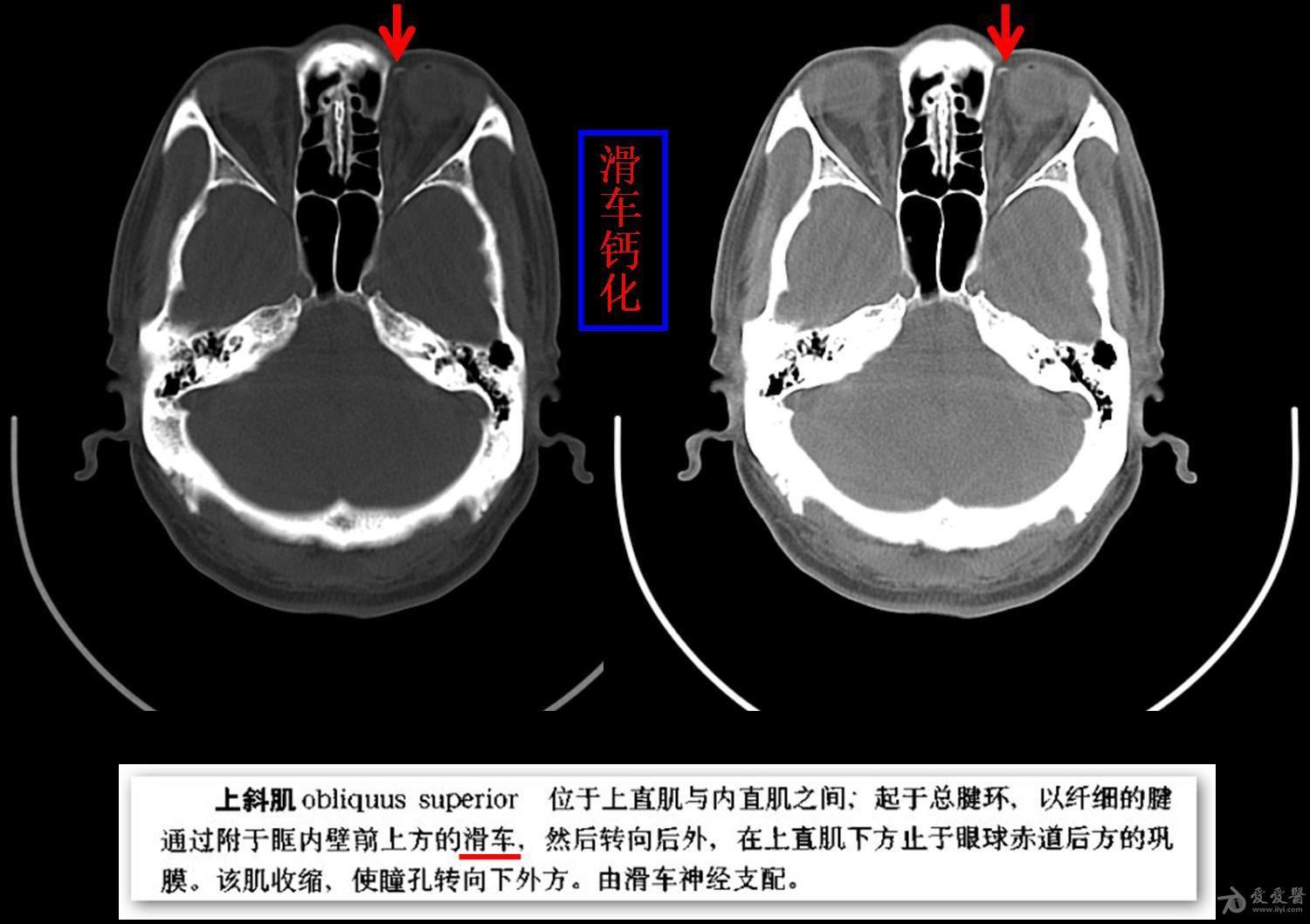 医学影像学讨论版 - 爱爱医医学论坛