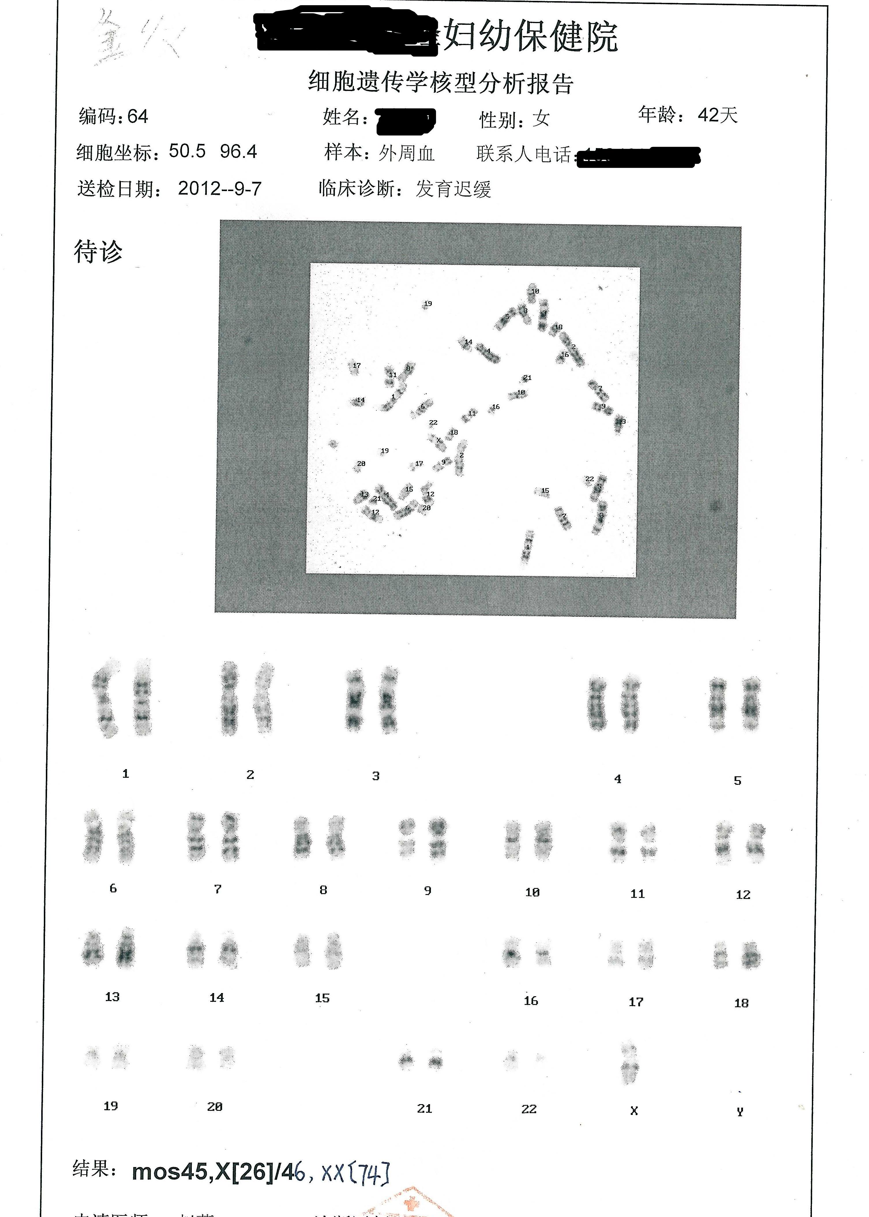 染色体单子图片图片