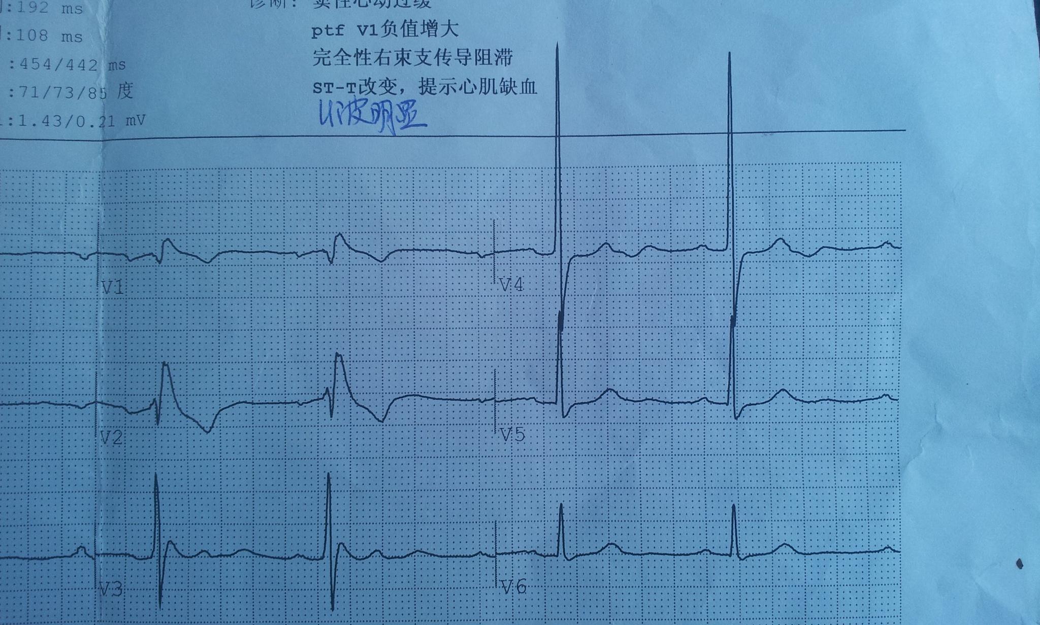 心电图脑电图专业讨论版 - 爱爱医医学论坛
