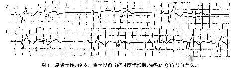 洪葵:j波和epsilon波的识别和临床意义