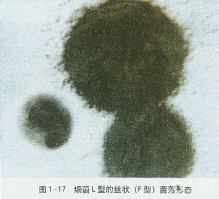 微生物图谱之细菌形态及结构
