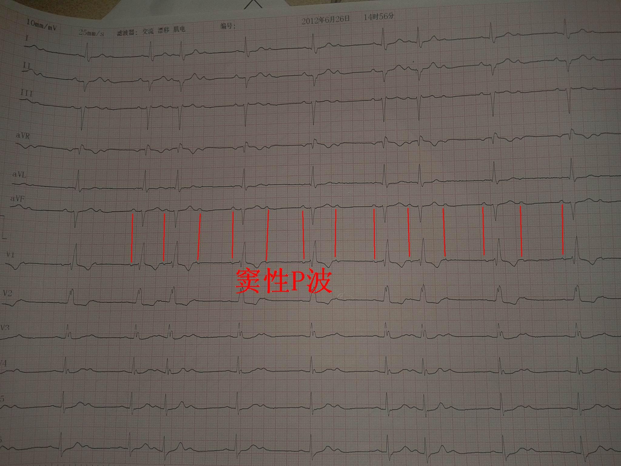 请教版主和山羊老师 