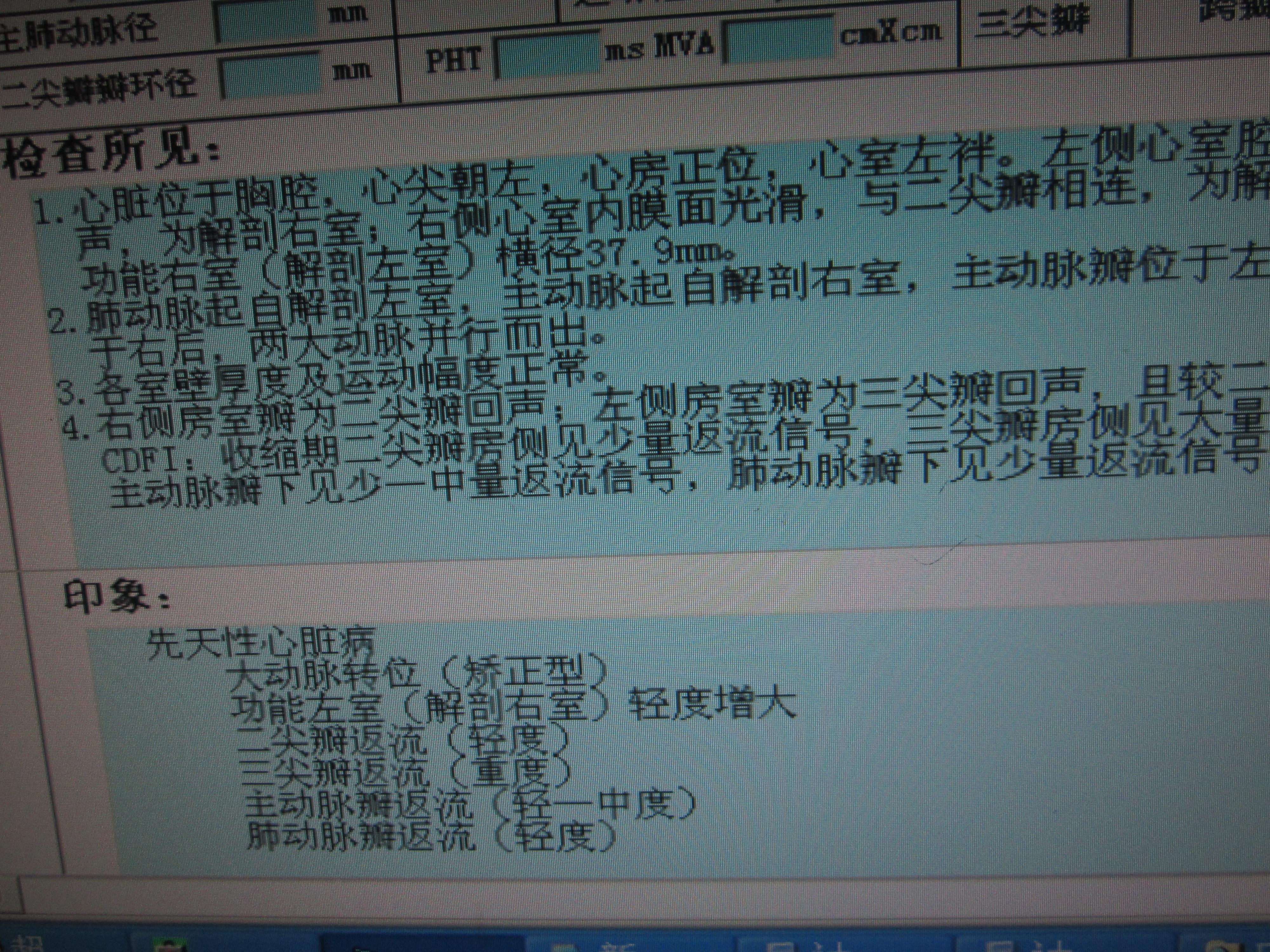 大动脉转位(矫正型 超声医学讨论版 爱爱医医学论坛