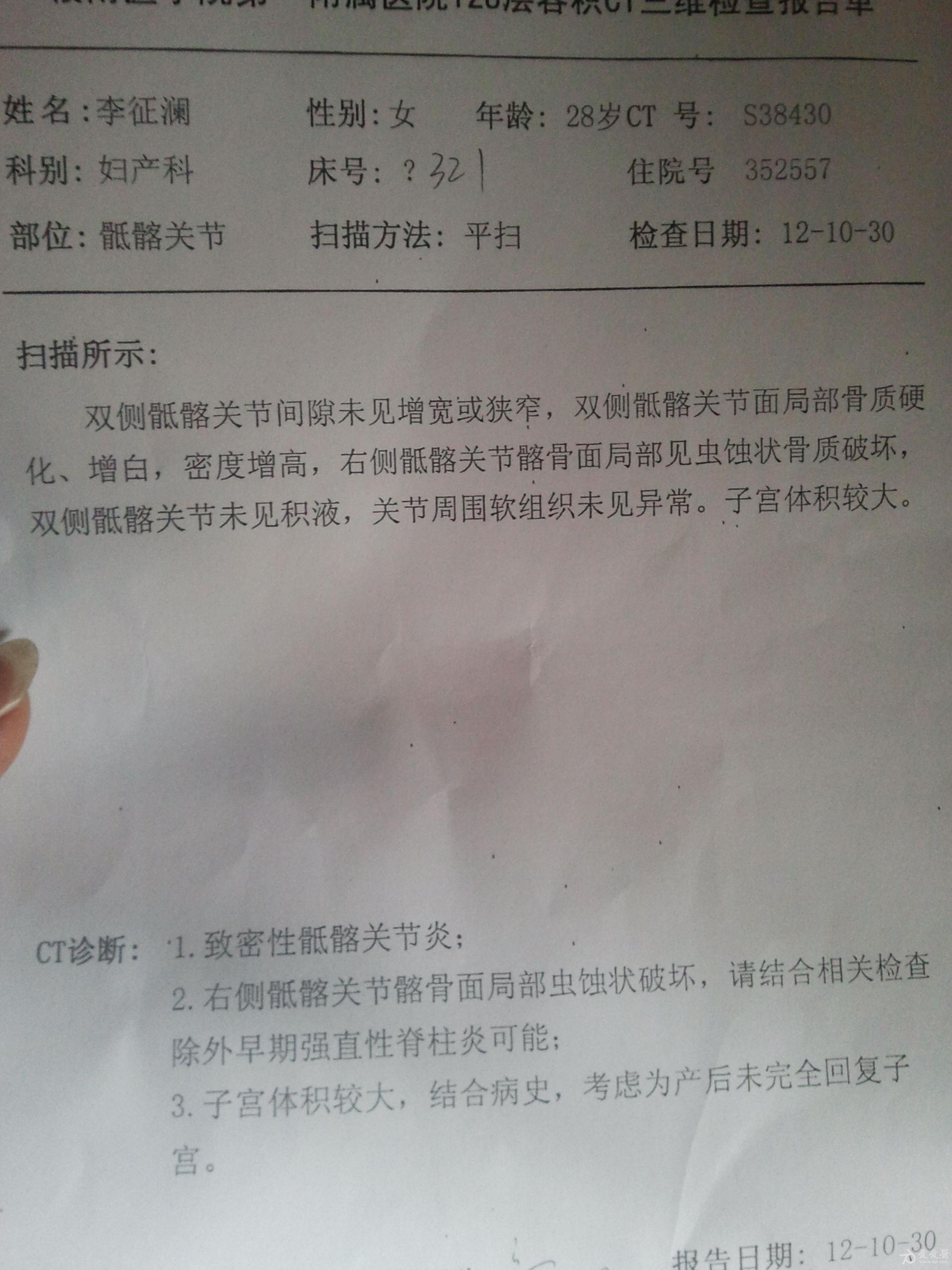 一边*疼痛下不了床,一直7天没有好转,经ct检查确诊是致密性骶髂关节