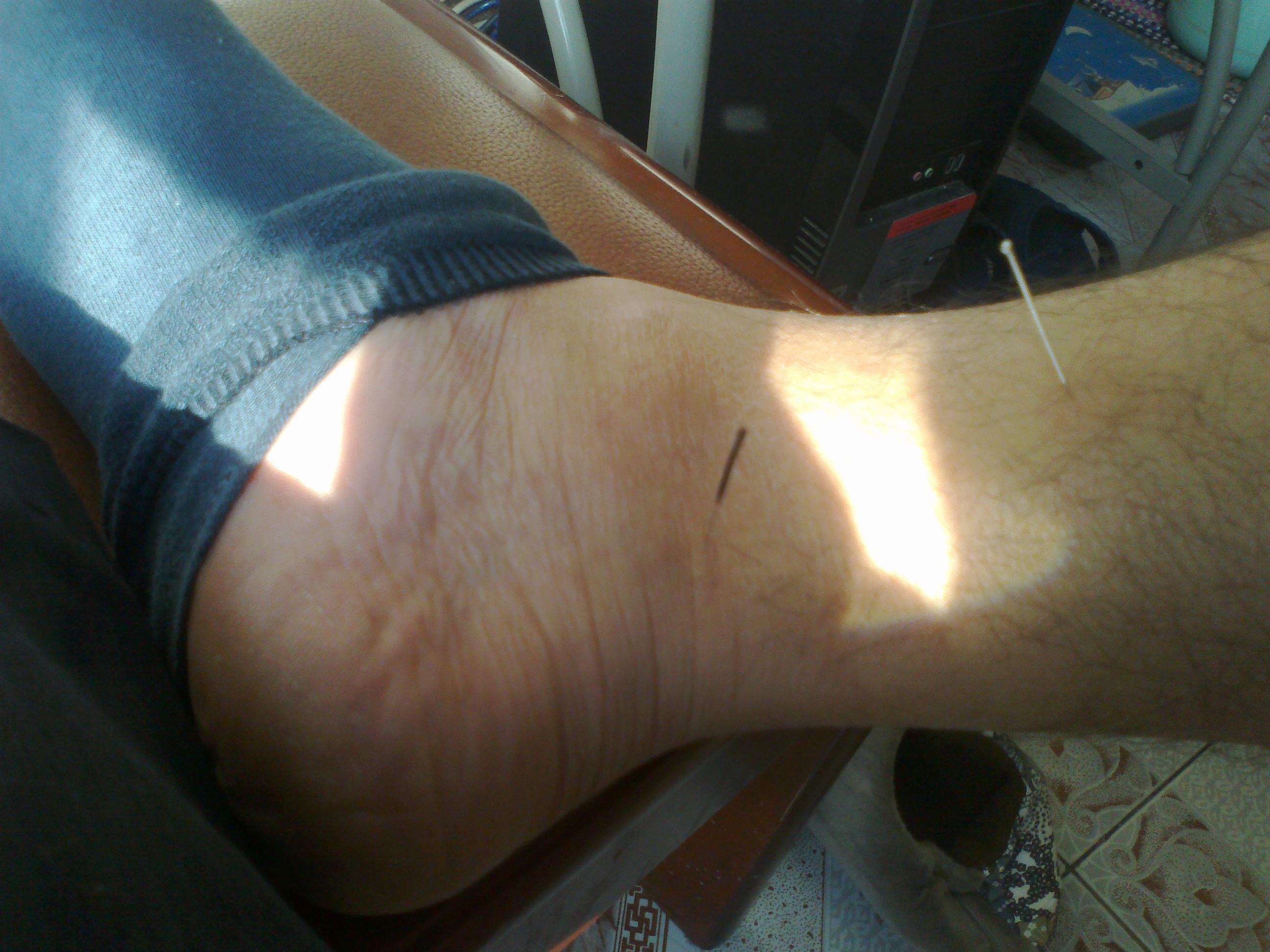 **里太溪,三阴交,请指点位置对不对?谢谢