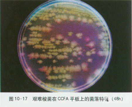 微生物图谱之厌氧菌