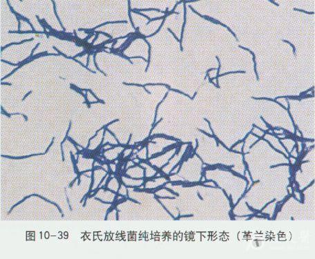 微生物图谱之厌氧菌