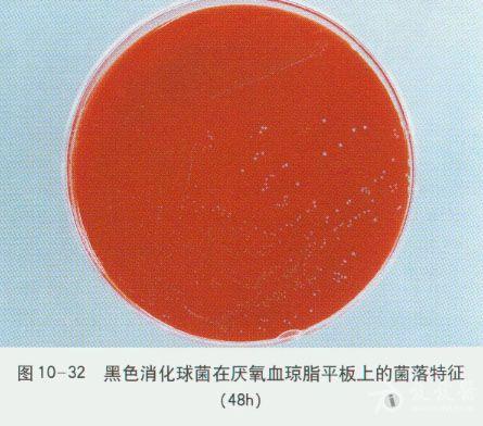 微生物图谱之厌氧菌