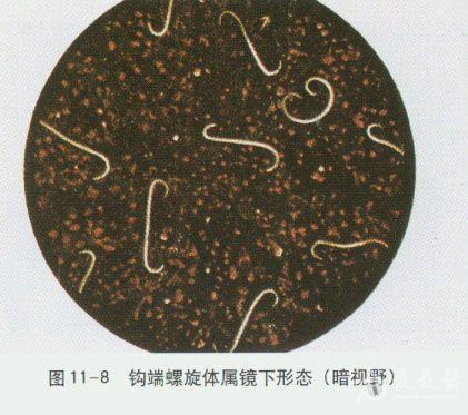 钩端螺旋体 显微镜图片