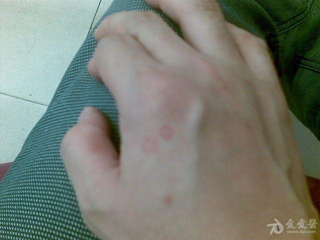 以后出现的两个红圈一个小时左右消失了