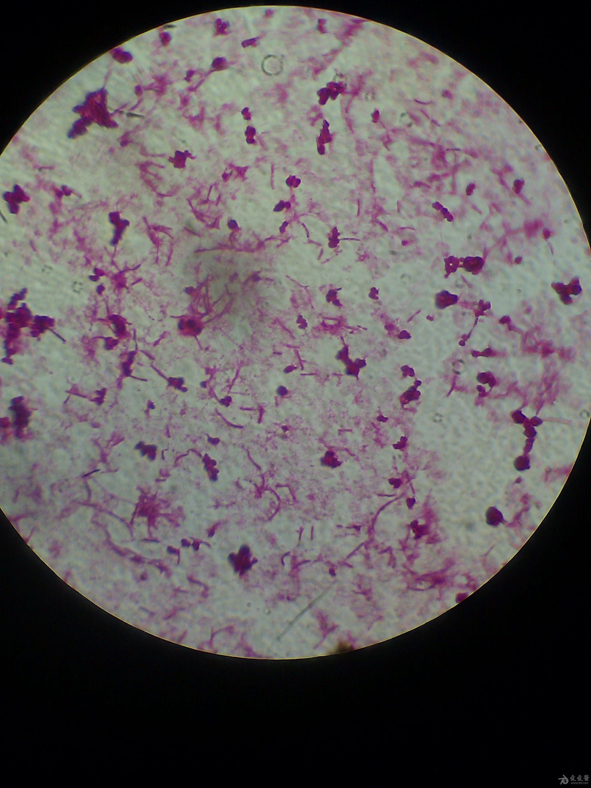 齿垢中的细菌革兰染色图片