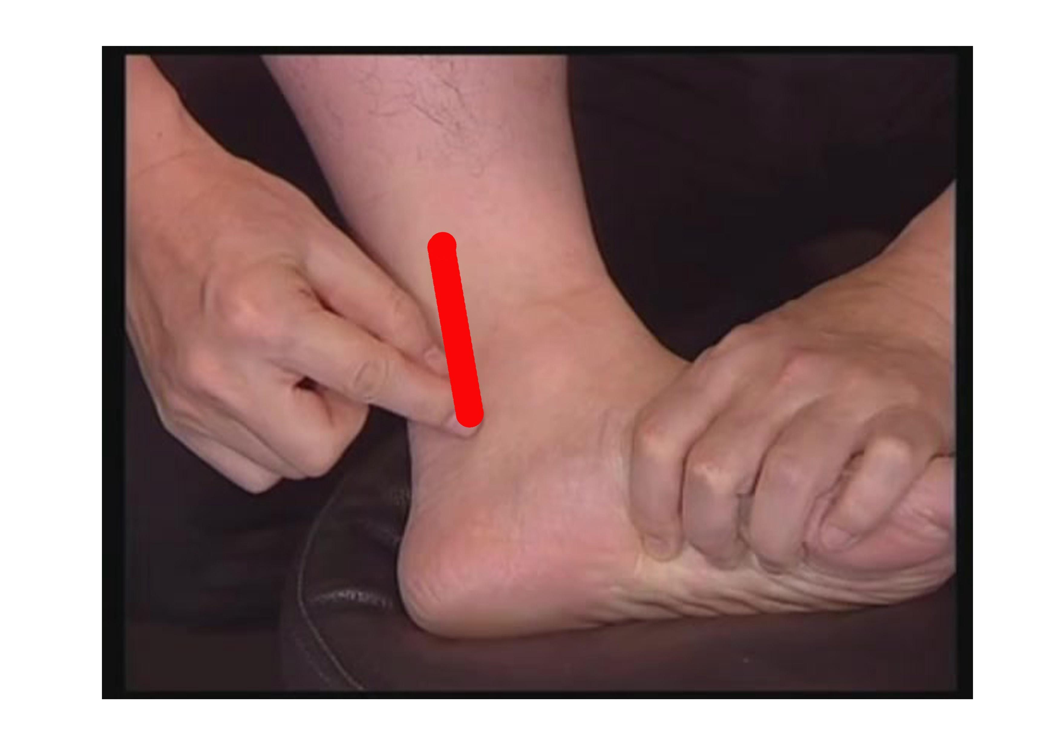 原始点疗法图片