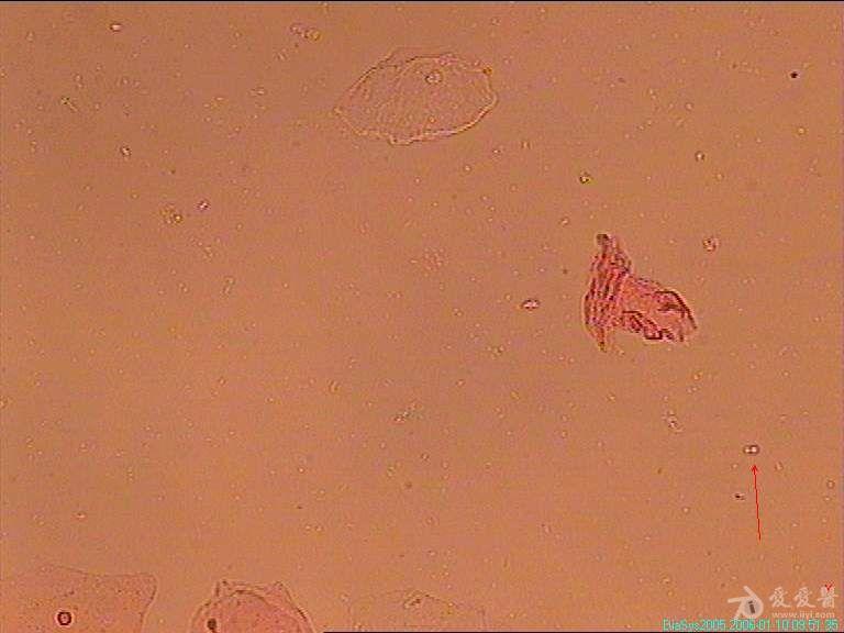 白带真菌孢子图片