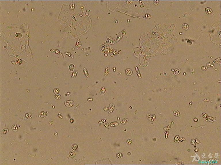 白带霉菌显微镜下图片图片