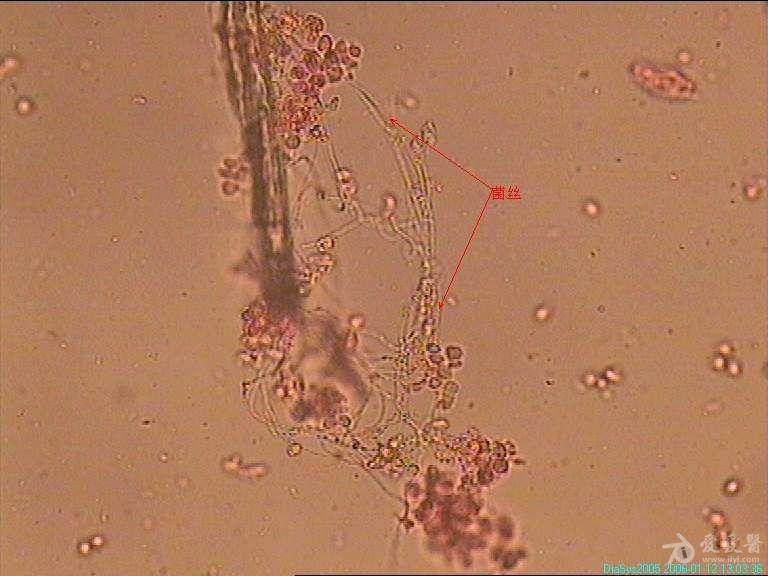 白带霉菌菌丝图片图片